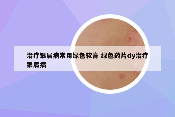 治疗银屑病常用绿色软膏 绿色药片dy治疗银屑病