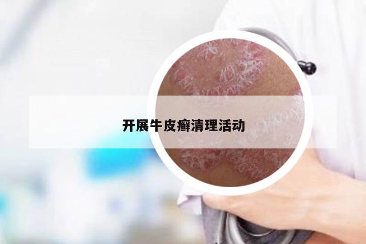 开展牛皮癣清理活动