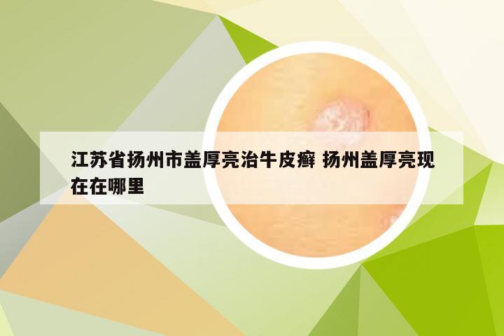 江苏省扬州市盖厚亮治牛皮癣 扬州盖厚亮现在在哪里