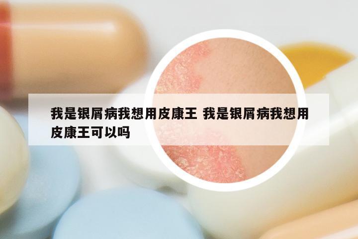 我是银屑病我想用皮康王 我是银屑病我想用皮康王可以吗