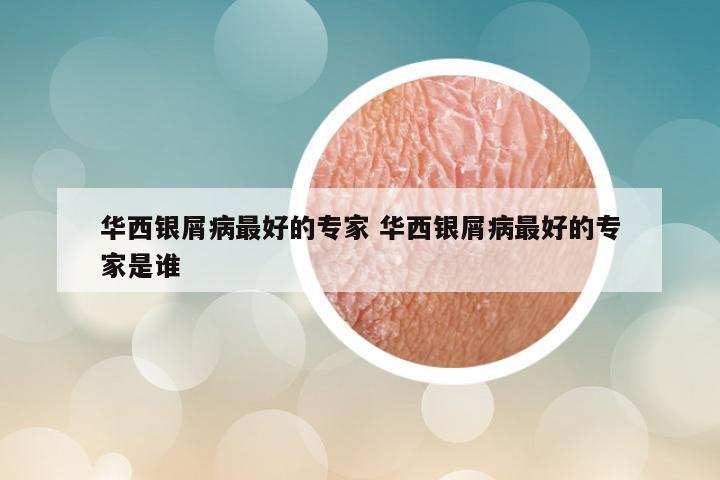 华西银屑病最好的专家 华西银屑病最好的专家是谁