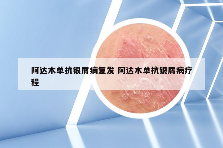 阿达木单抗银屑病复发 阿达木单抗银屑病疗程