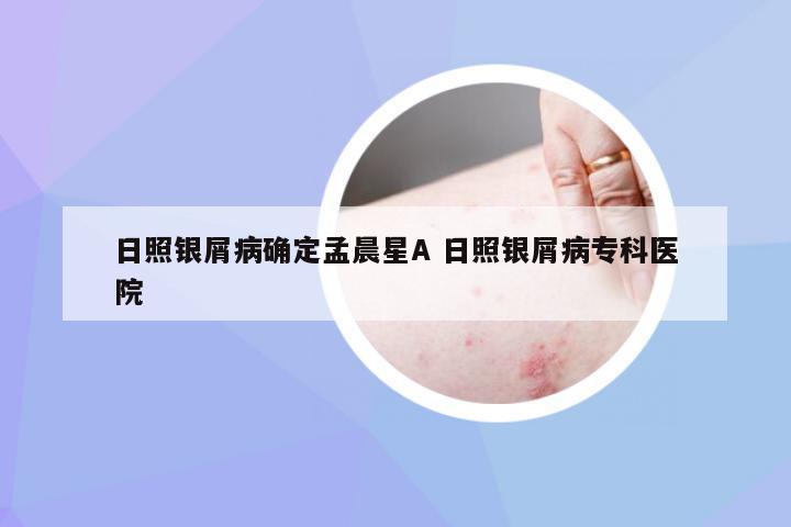 日照银屑病确定孟晨星A 日照银屑病专科医院