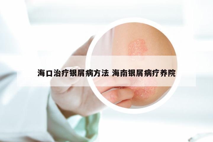海口治疗银屑病方法 海南银屑病疗养院
