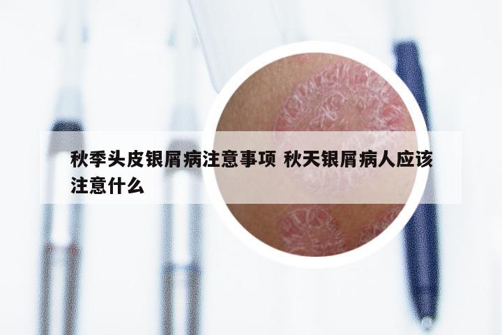 秋季头皮银屑病注意事项 秋天银屑病人应该注意什么
