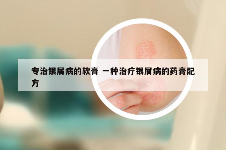 专治银屑病的软膏 一种治疗银屑病的药膏配方