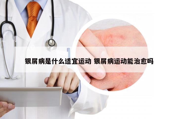 银屑病是什么适宜运动 银屑病运动能治愈吗