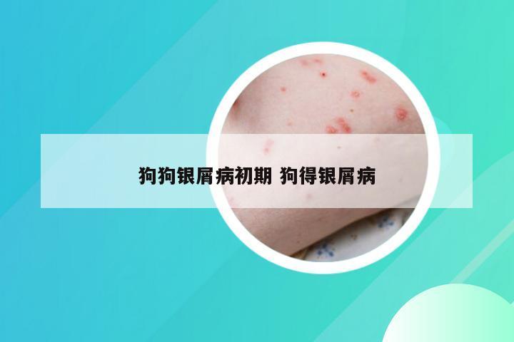 狗狗银屑病初期 狗得银屑病
