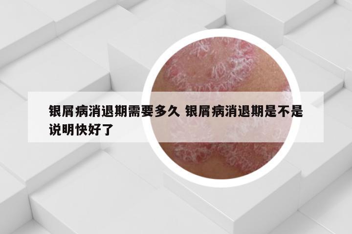 银屑病消退期需要多久 银屑病消退期是不是说明快好了