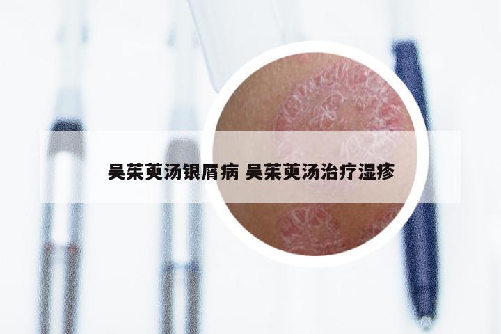 吴茱萸汤银屑病 吴茱萸汤治疗湿疹