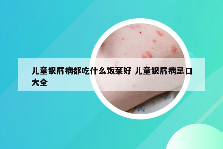 儿童银屑病都吃什么饭菜好 儿童银屑病忌口大全
