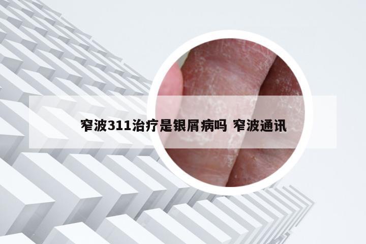 窄波311治疗是银屑病吗 窄波通讯