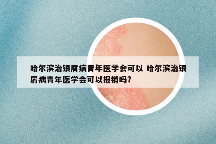 哈尔滨治银屑病青年医学会可以 哈尔滨治银屑病青年医学会可以报销吗?