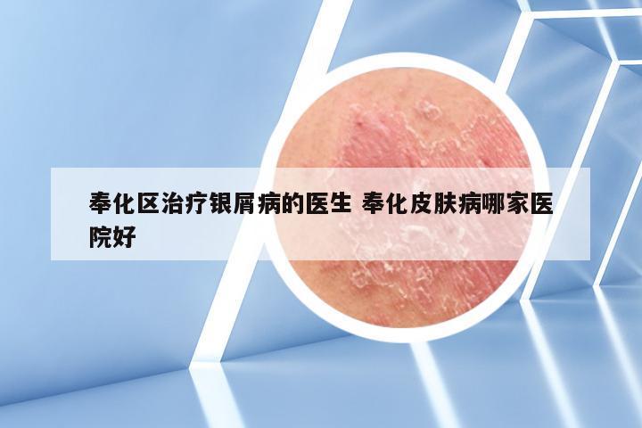 奉化区治疗银屑病的医生 奉化皮肤病哪家医院好