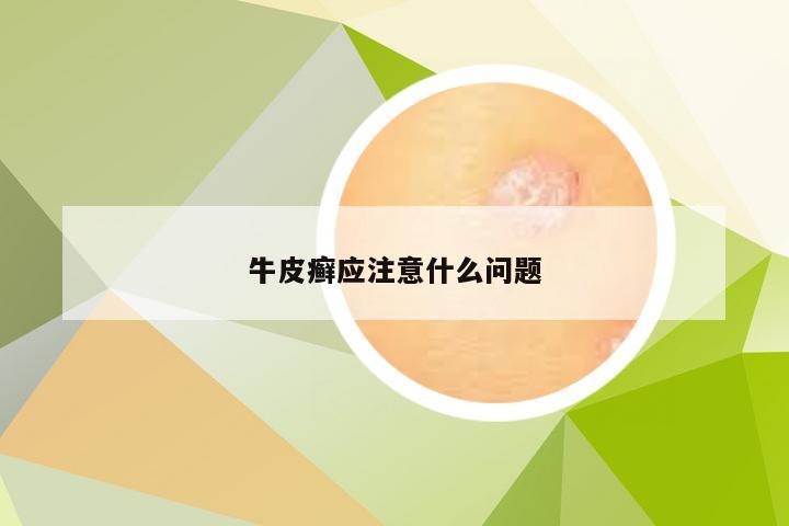 牛皮癣应注意什么问题