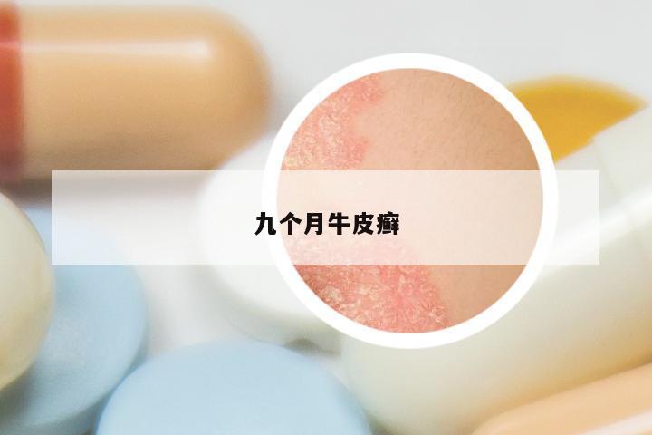 九个月牛皮癣