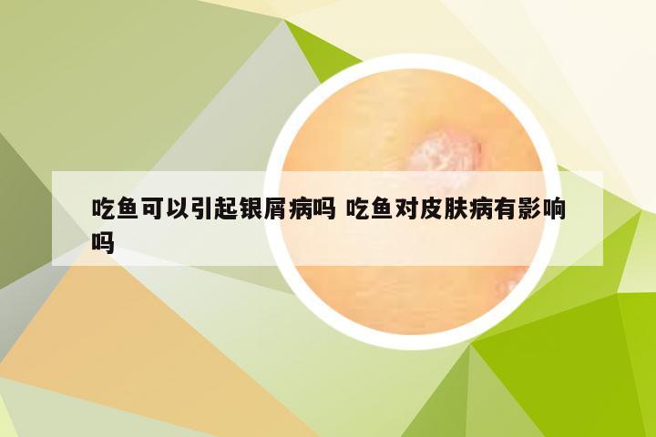 吃鱼可以引起银屑病吗 吃鱼对皮肤病有影响吗