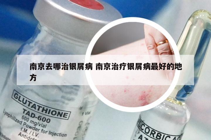 南京去哪治银屑病 南京治疗银屑病最好的地方
