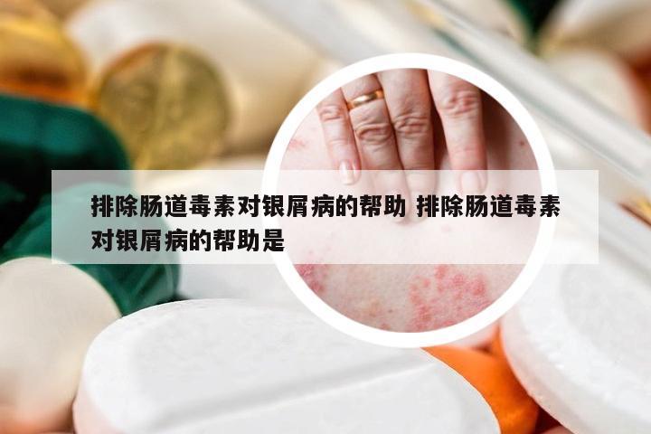 排除肠道毒素对银屑病的帮助 排除肠道毒素对银屑病的帮助是