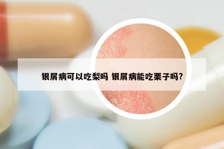 银屑病可以吃梨吗 银屑病能吃栗子吗?