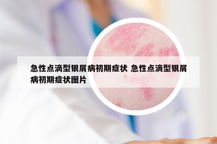 急性点滴型银屑病初期症状 急性点滴型银屑病初期症状图片