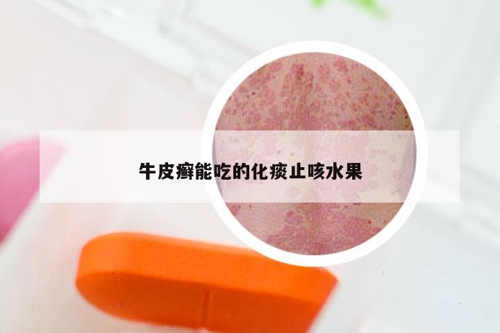 牛皮癣能吃的化痰止咳水果