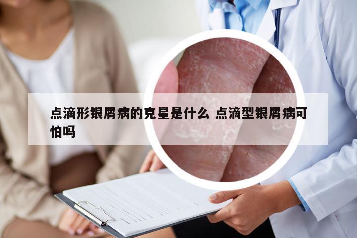 点滴形银屑病的克星是什么 点滴型银屑病可怕吗