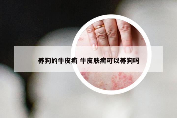 养狗的牛皮癣 牛皮肤癣可以养狗吗