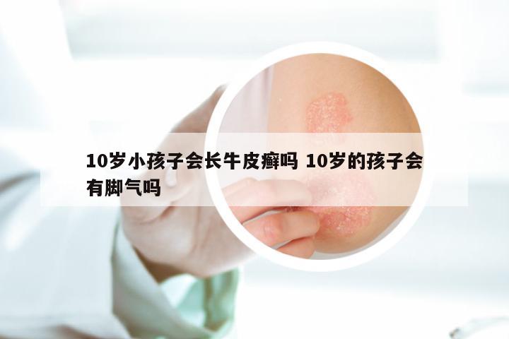 10岁小孩子会长牛皮癣吗 10岁的孩子会有脚气吗