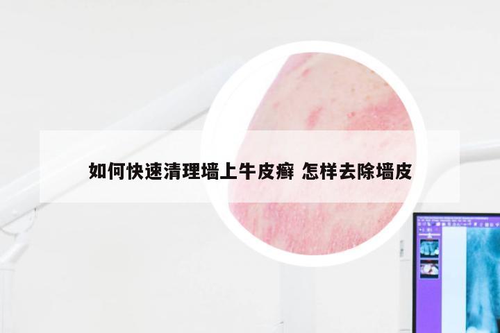 如何快速清理墙上牛皮癣 怎样去除墙皮
