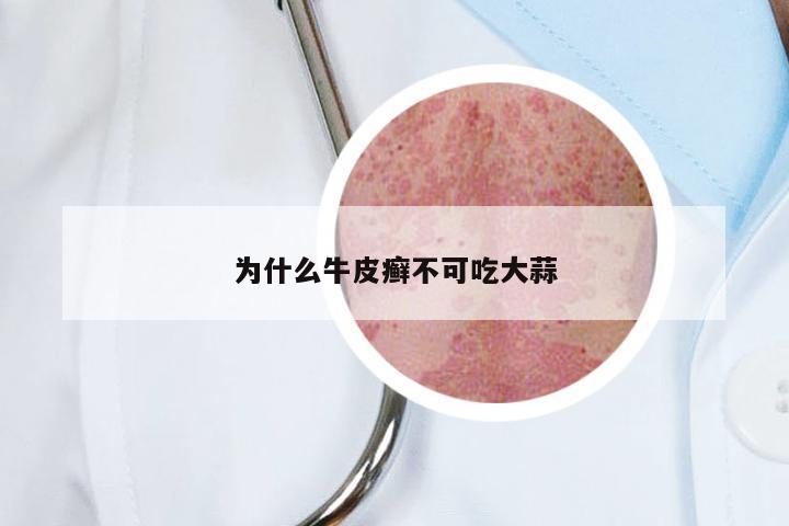 为什么牛皮癣不可吃大蒜