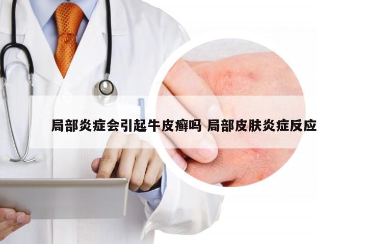 局部炎症会引起牛皮癣吗 局部皮肤炎症反应