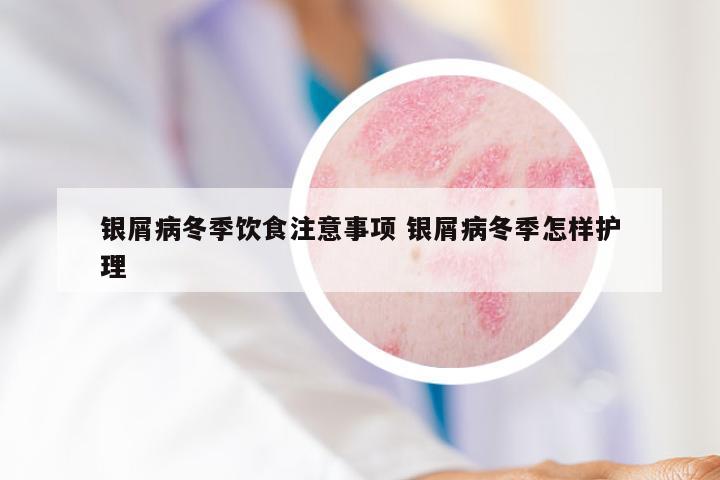 银屑病冬季饮食注意事项 银屑病冬季怎样护理