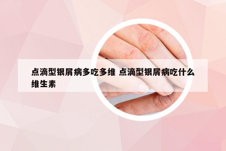 点滴型银屑病多吃多维 点滴型银屑病吃什么维生素