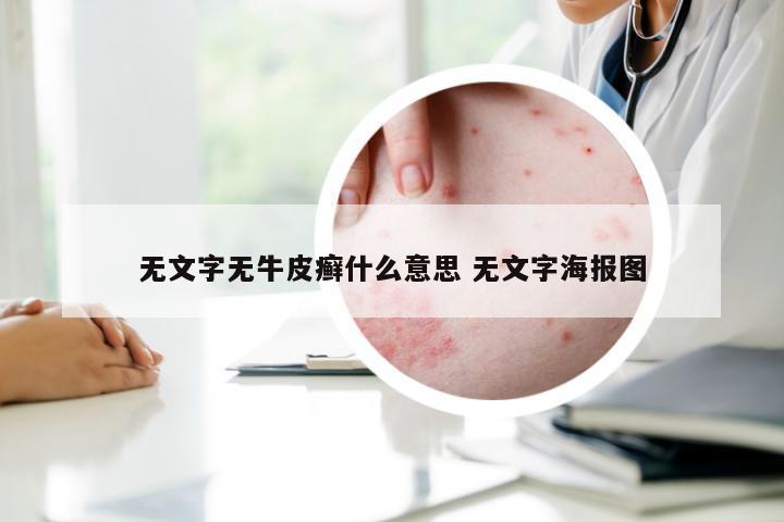 无文字无牛皮癣什么意思 无文字海报图