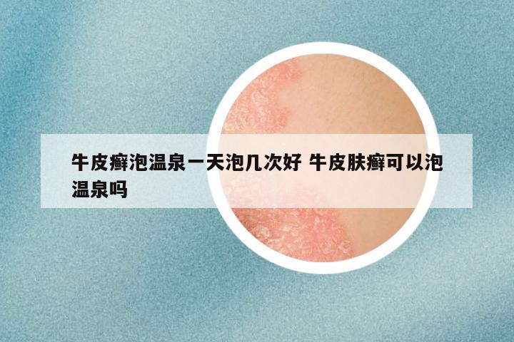 牛皮癣泡温泉一天泡几次好 牛皮肤癣可以泡温泉吗