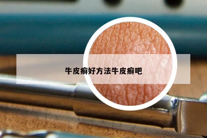 牛皮癣好方法牛皮癣吧