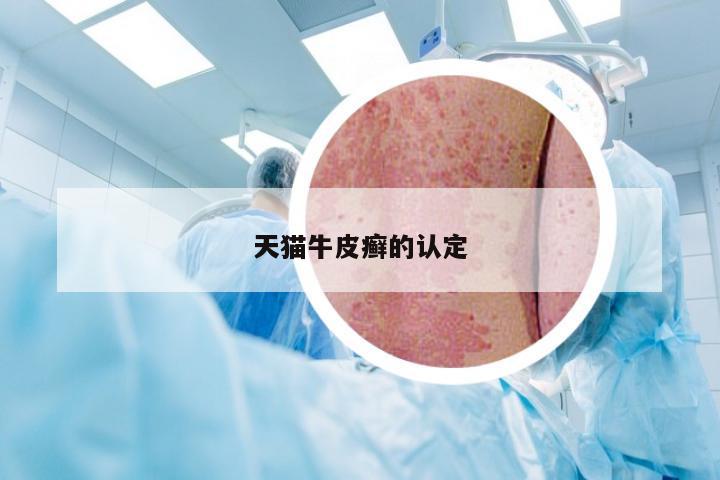 天猫牛皮癣的认定