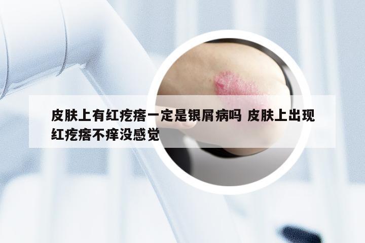皮肤上有红疙瘩一定是银屑病吗 皮肤上出现红疙瘩不痒没感觉