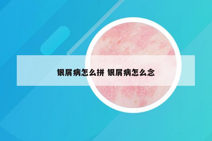 银屑病怎么拼 银屑病怎么念