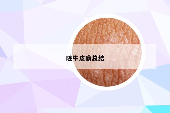 除牛皮癣总结