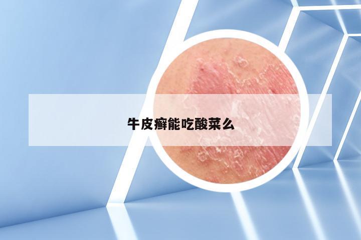 牛皮癣能吃酸菜么