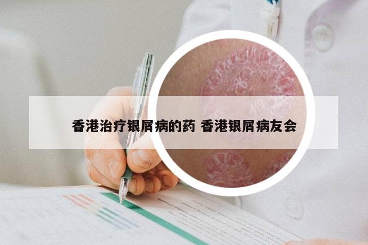 香港治疗银屑病的药 香港银屑病友会