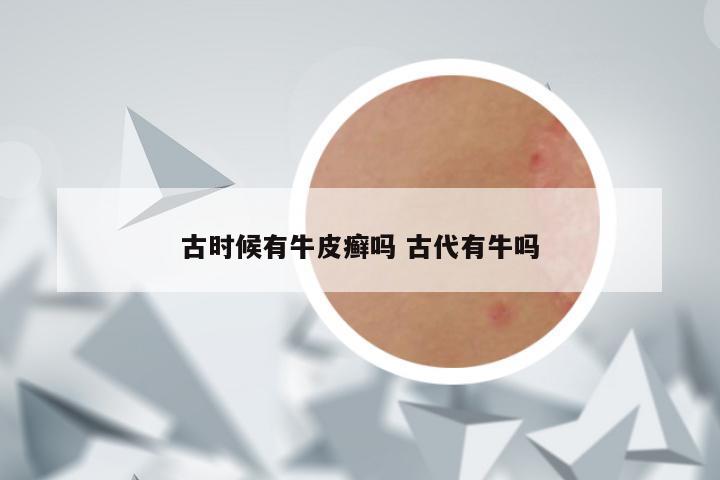 古时候有牛皮癣吗 古代有牛吗