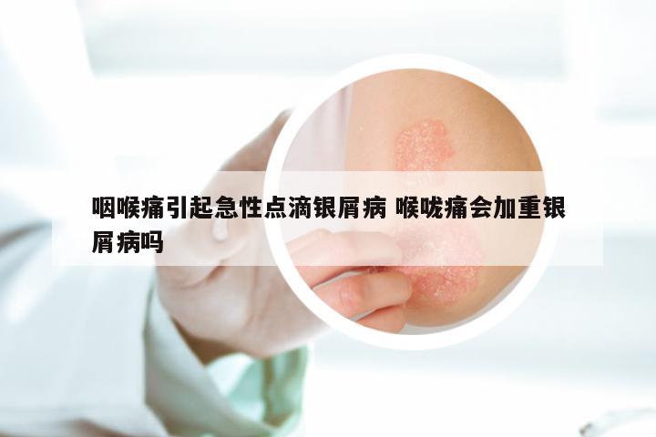 咽喉痛引起急性点滴银屑病 喉咙痛会加重银屑病吗