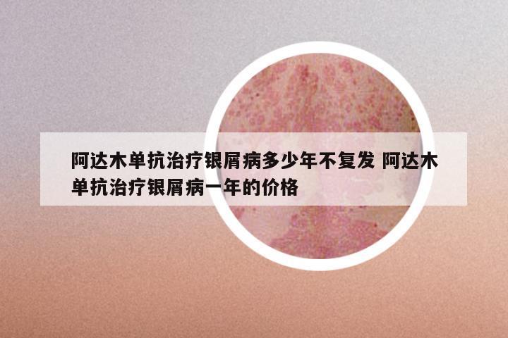 阿达木单抗治疗银屑病多少年不复发 阿达木单抗治疗银屑病一年的价格