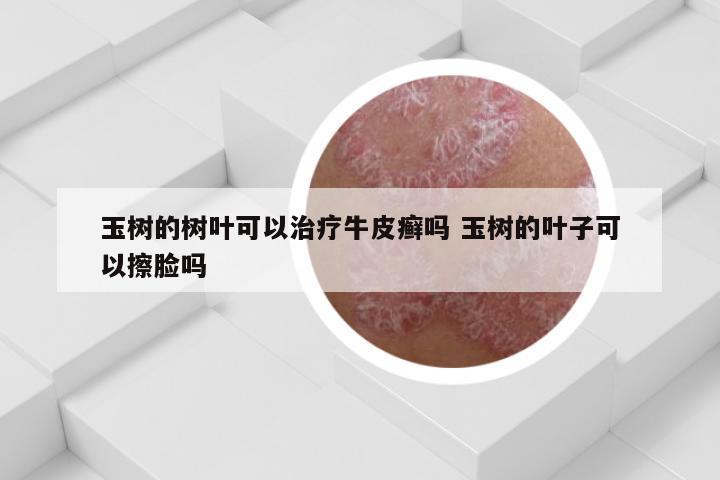玉树的树叶可以治疗牛皮癣吗 玉树的叶子可以擦脸吗