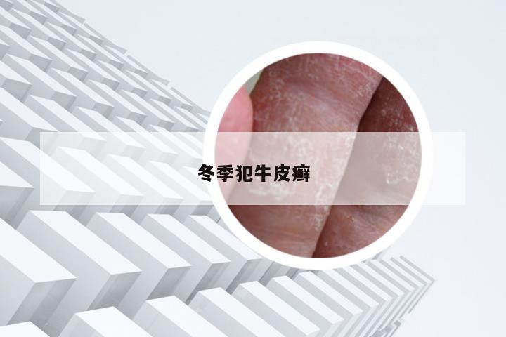 冬季犯牛皮癣