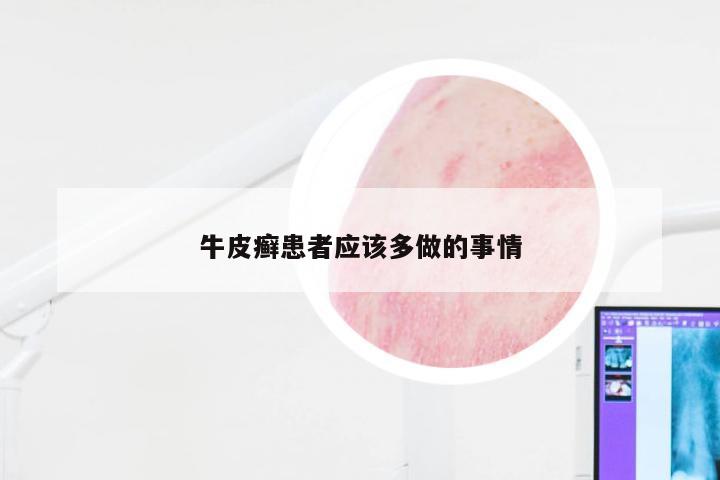 牛皮癣患者应该多做的事情