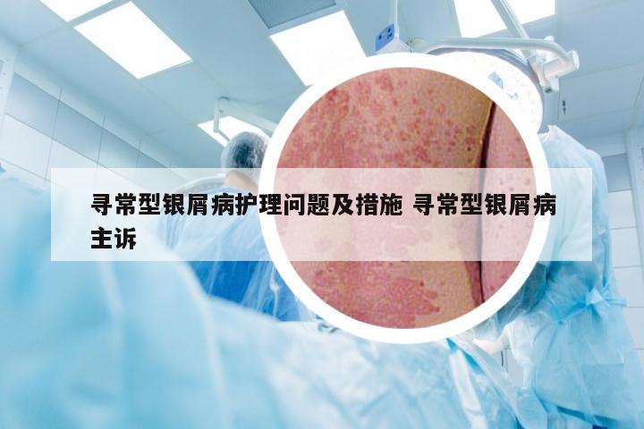 寻常型银屑病护理问题及措施 寻常型银屑病主诉